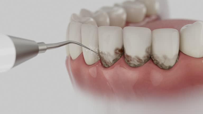 Trusted Tooth Extraction service in Georgetown, DE - Dentist Open Now